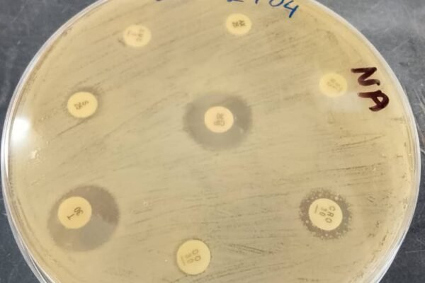 Laboratory report for multidrug resistant Klebsiela Spp in Uganda
